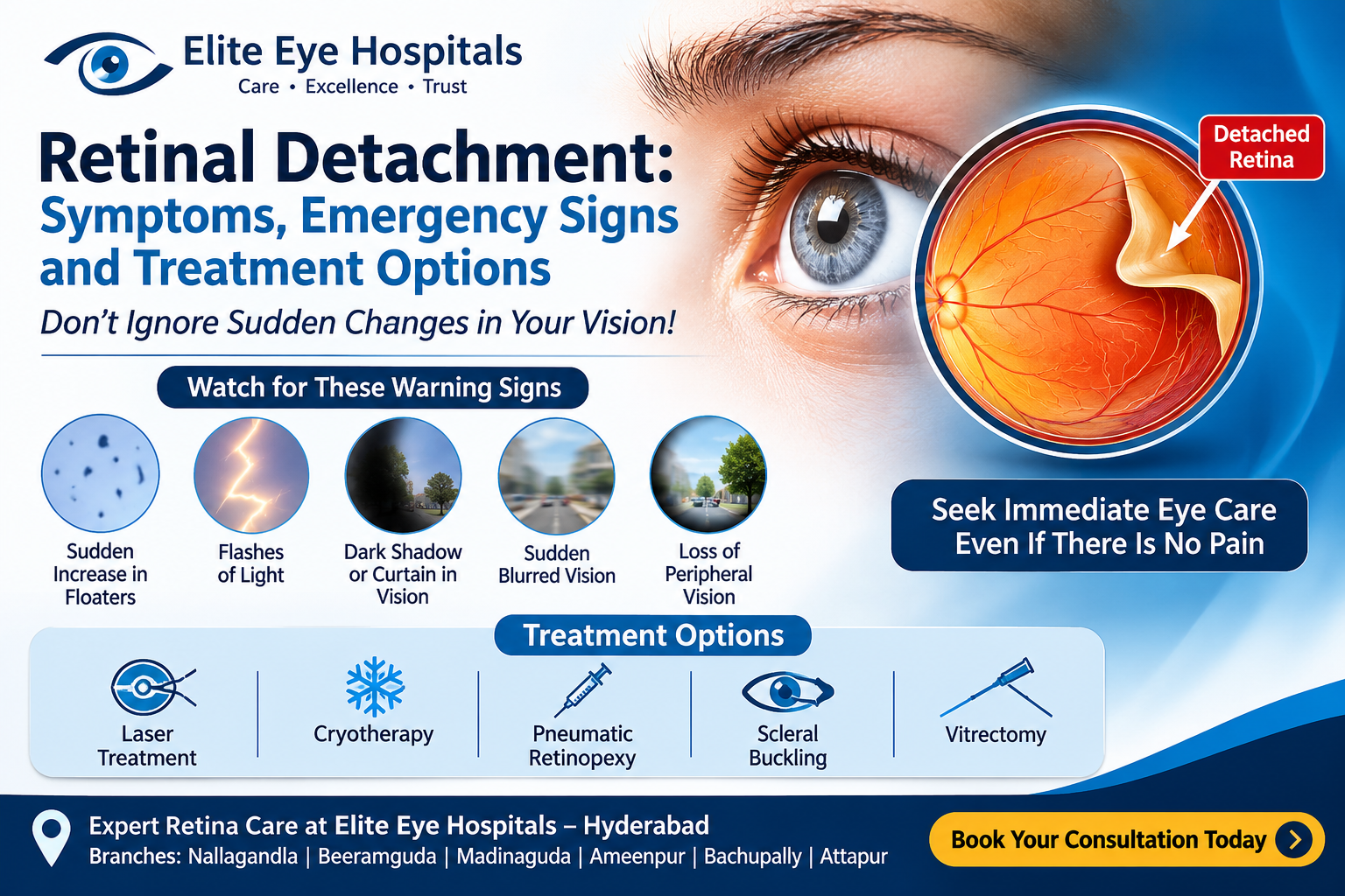 Retinal detachment symptoms, including flashes of light, sudden floaters and curtain-like shadows, with retinal treatment information at Elite Eye Hospitals in Hyderabad.